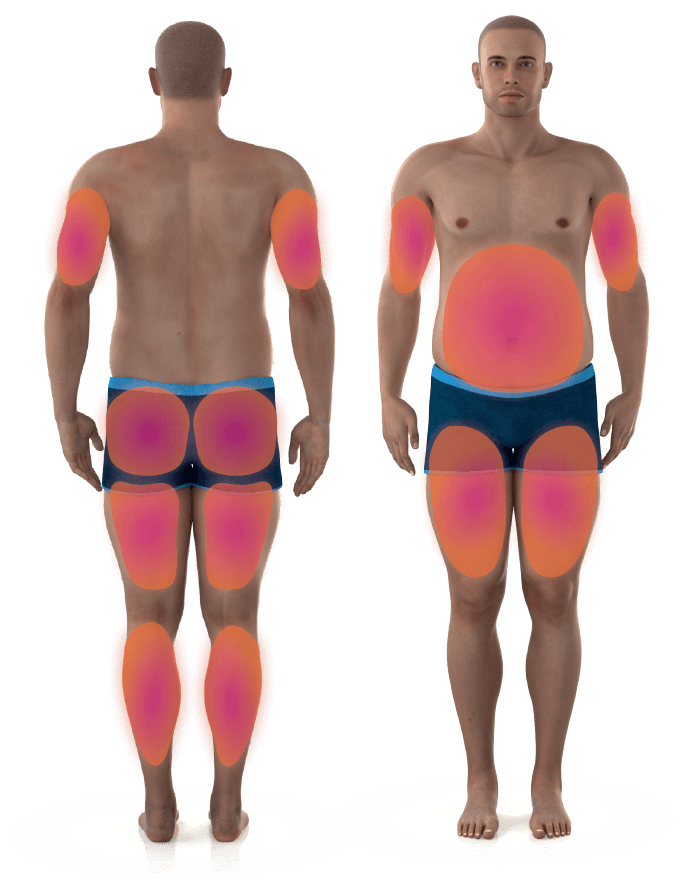 diagram showing the areas of the male body where emusculpt can help