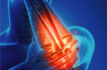 Image for choice number 5