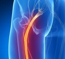 Image for choice number 7