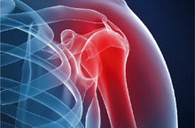 Image for choice number 4